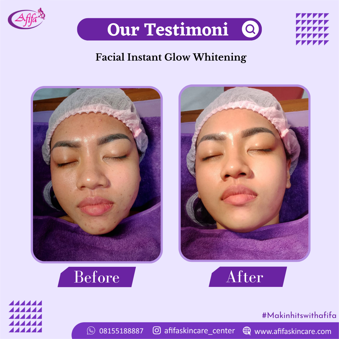 Facial Instant Glow Whitening (1)