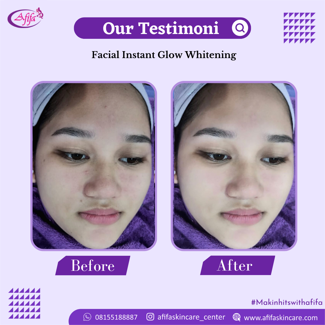 Facial Instant Glow Whitening