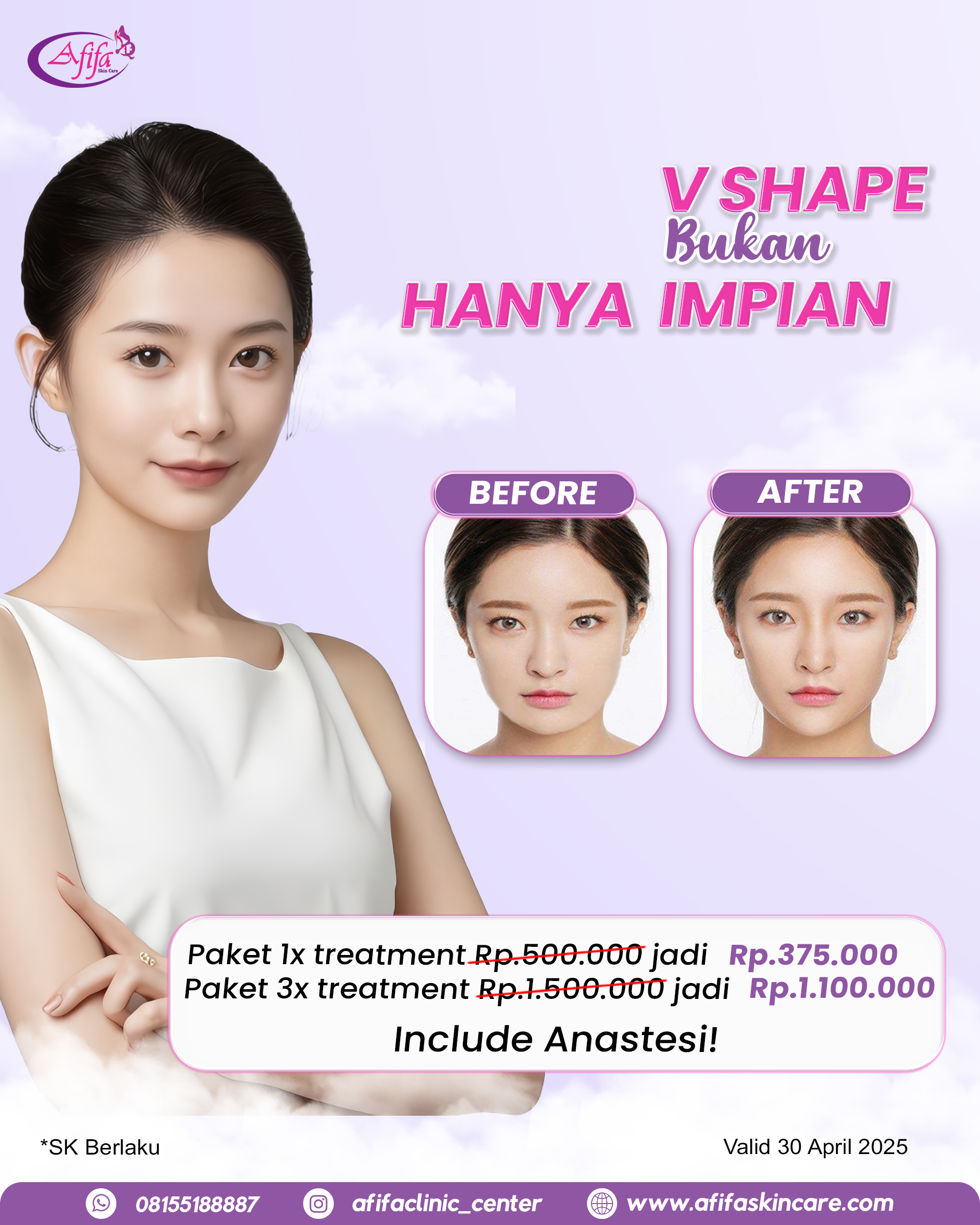 April V Shape