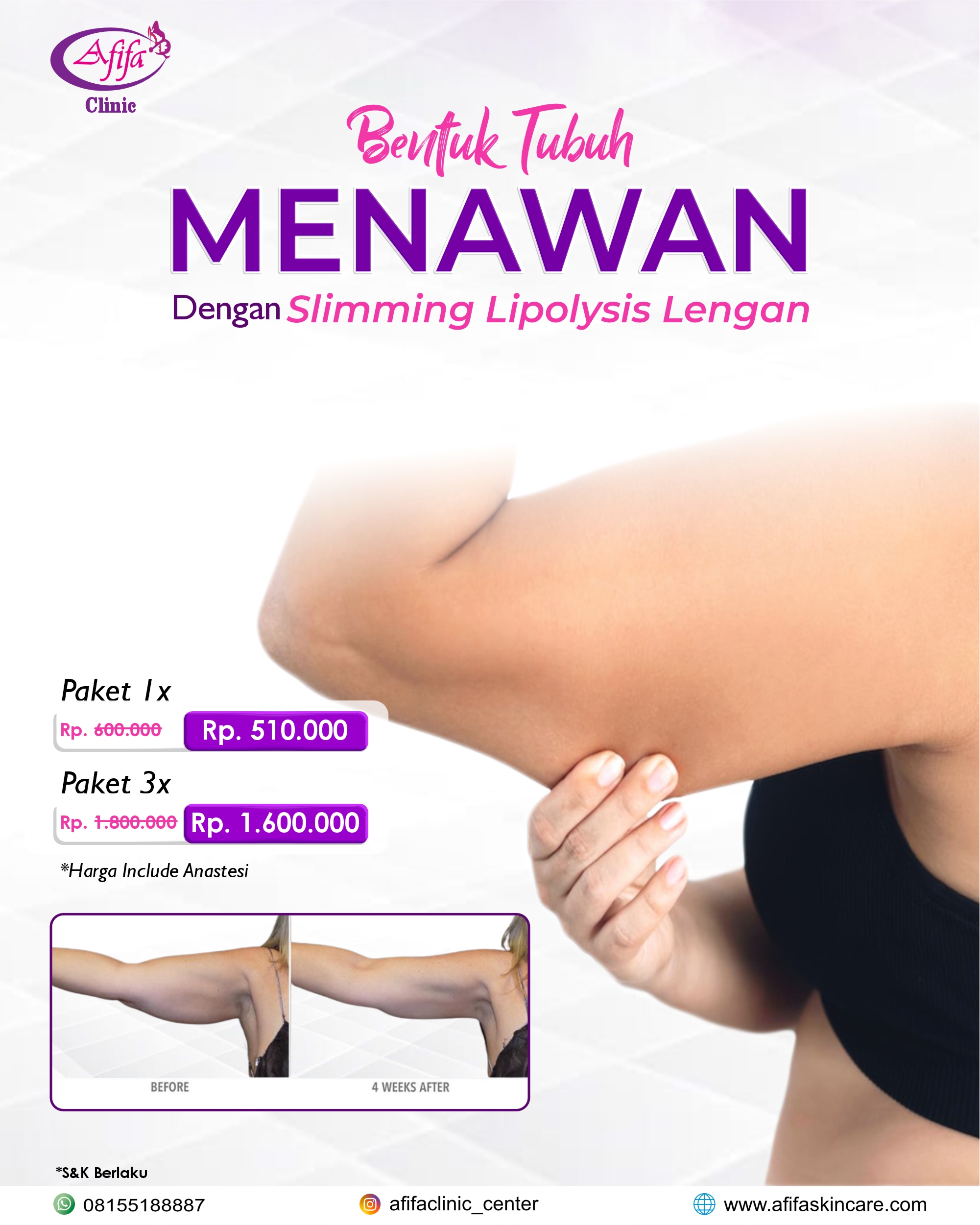 Slimming Lipolysis Lengan