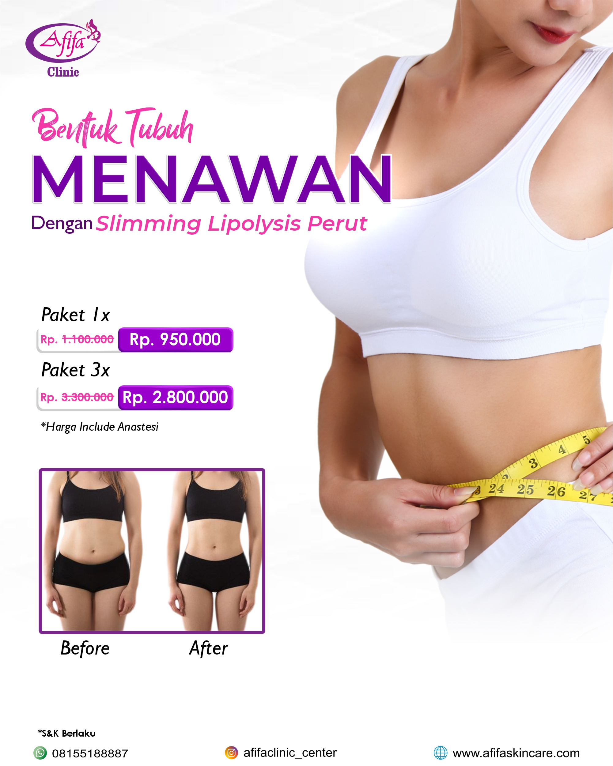 Sliming Lipolysis Perut