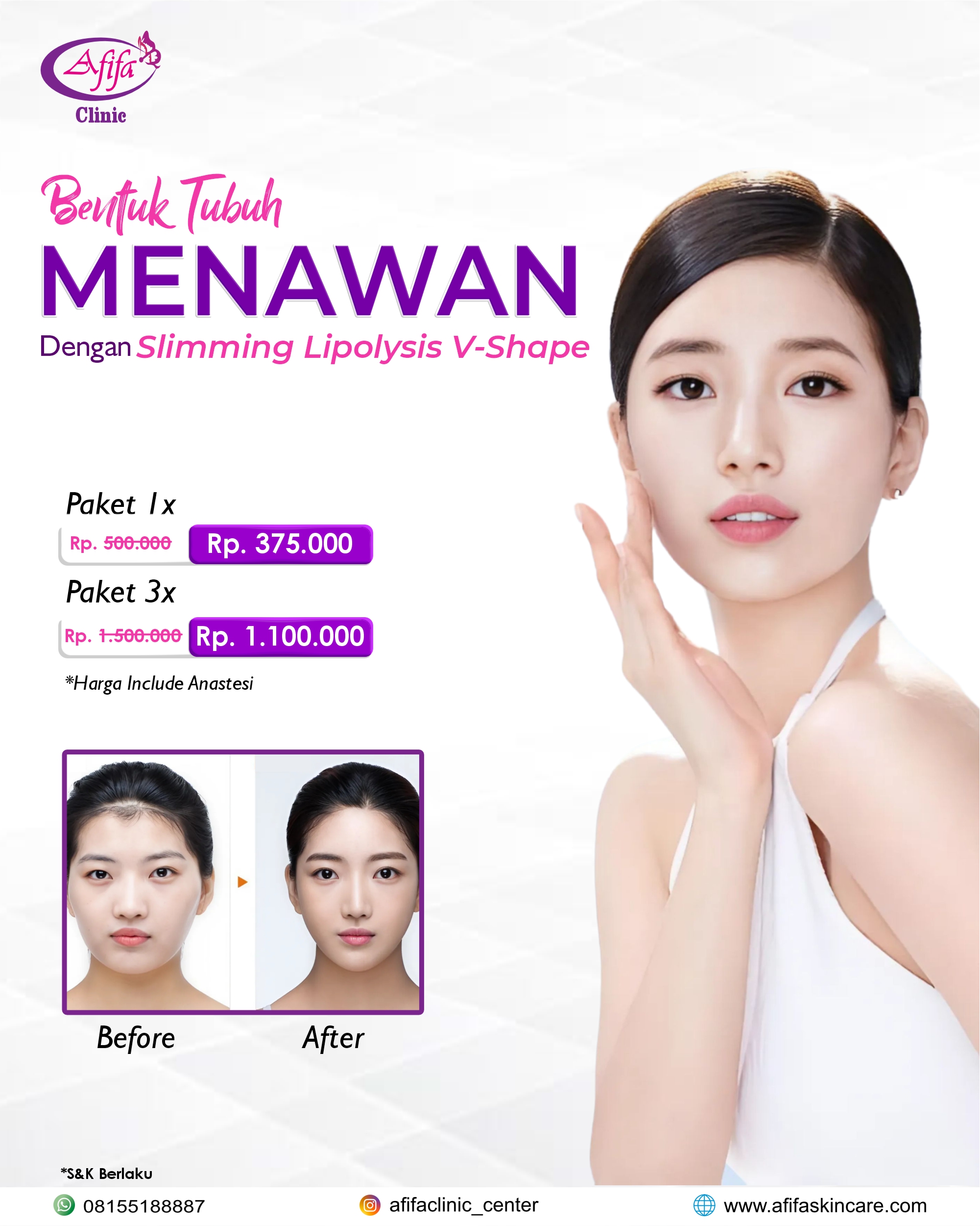 Slimming Lipolysis V shape
