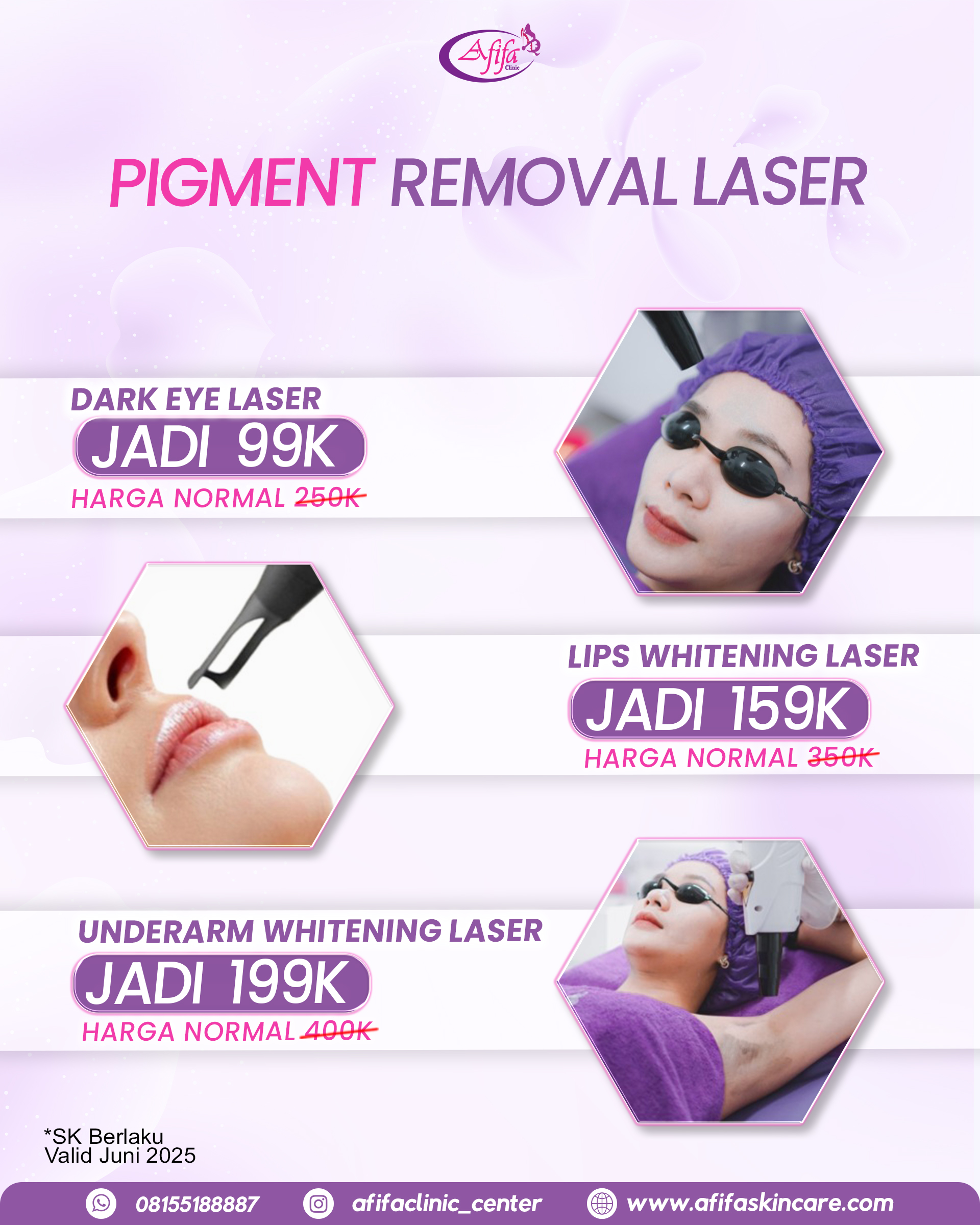 Juni Pigment Removal Laser