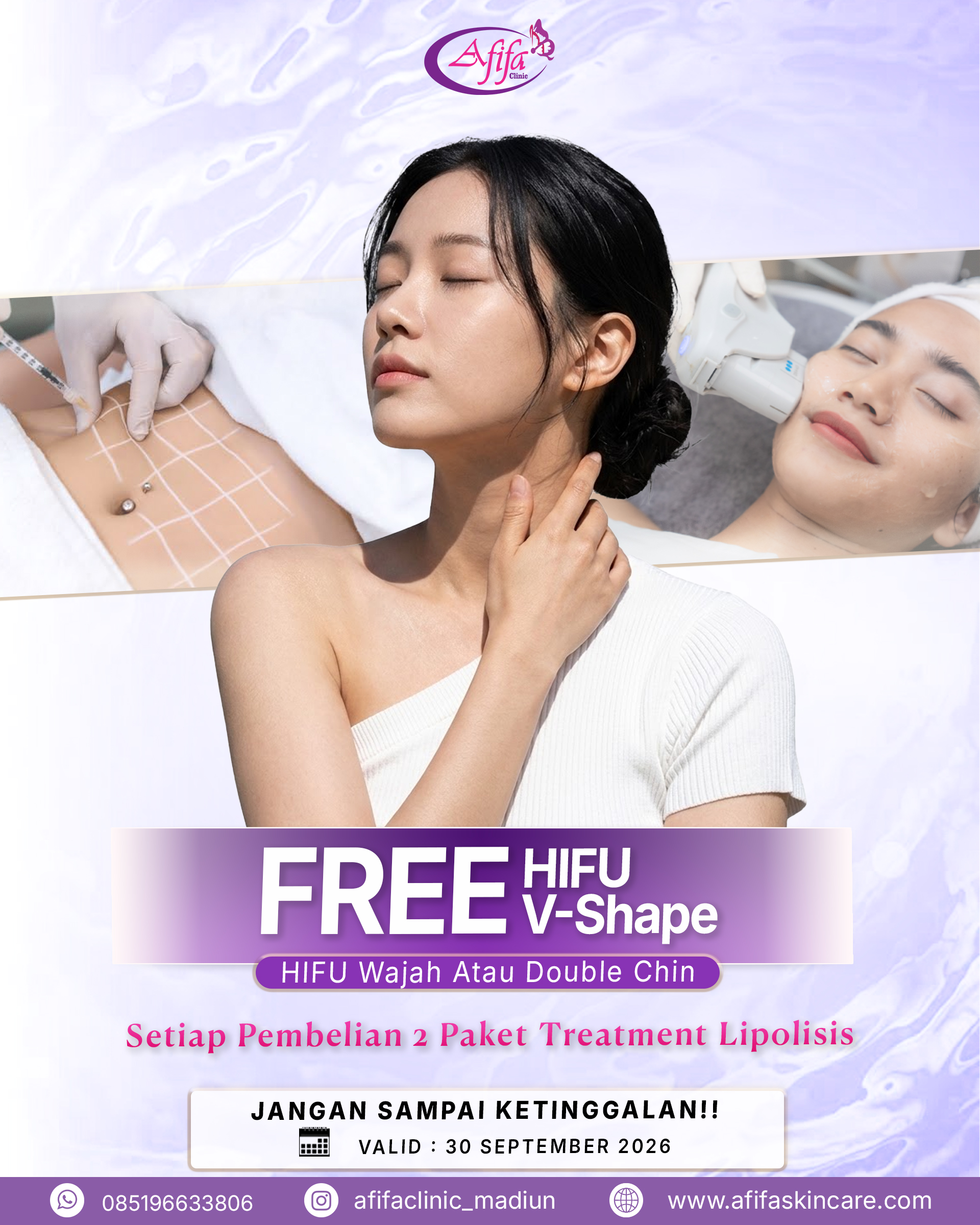 September Hifu Madiun
